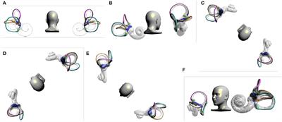 Simulation Study of Canal Switching in BPPV